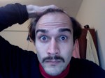 balding