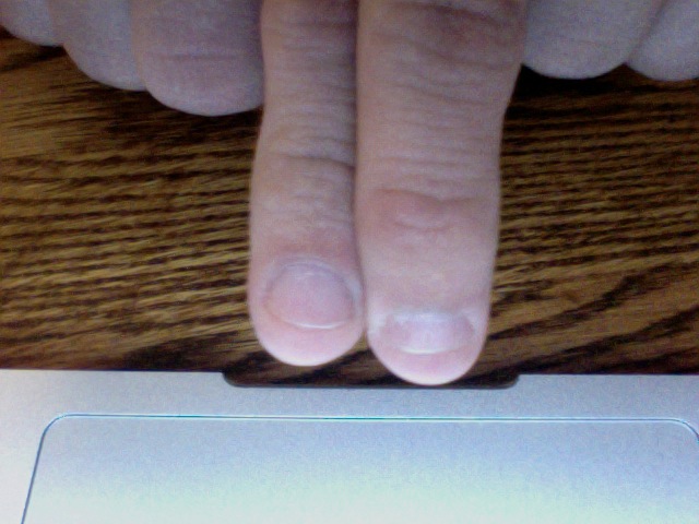 biting my nails. iting my nails is